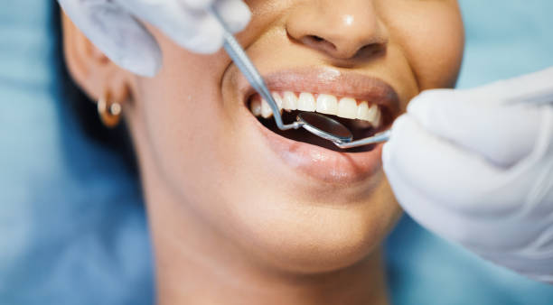 Best Emergency Dental Care for Abscessed Tooth in Centerville, GA